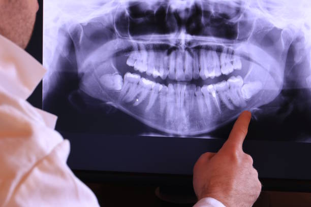 Best Emergency Tooth Extraction in Oak Hill, TN